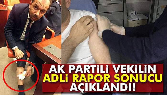 Adli Tıp 'AK Parti Trabzon Milletvekili ısırıldı' dedi