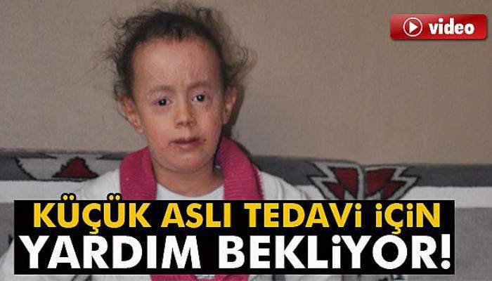  Küçük Aslı tedavi için yardım bekliyor