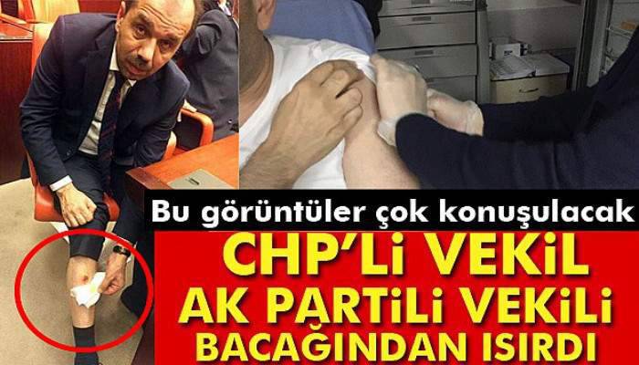  TBMM'de CHP Milletvekili, AK Partili Balta'yı bacağından ısırdı