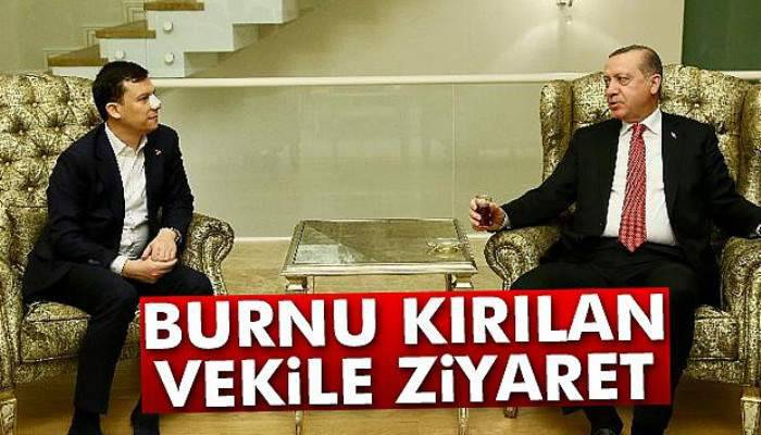 Burnu kırılan vekile ziyaret